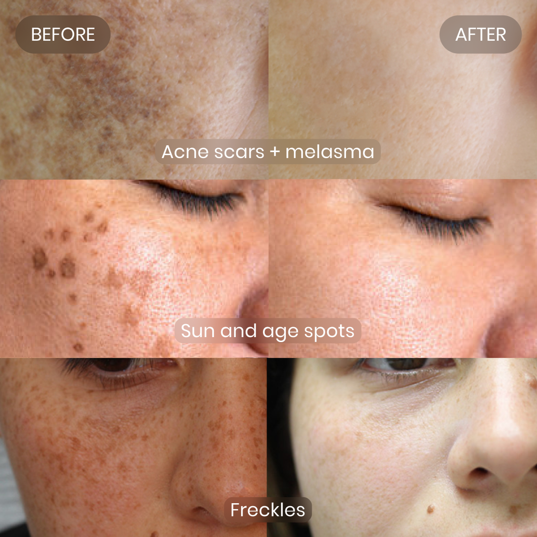 <p>Protect today, <em>prevent tomorrow</em></p>