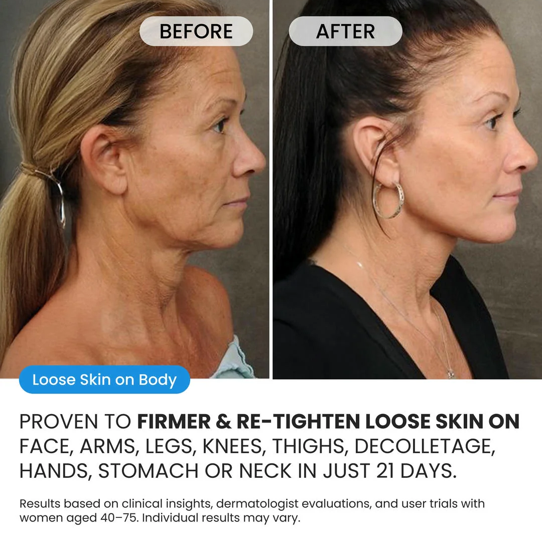 Advanced Crepe Fix for crepey, densely creased or paper like skin