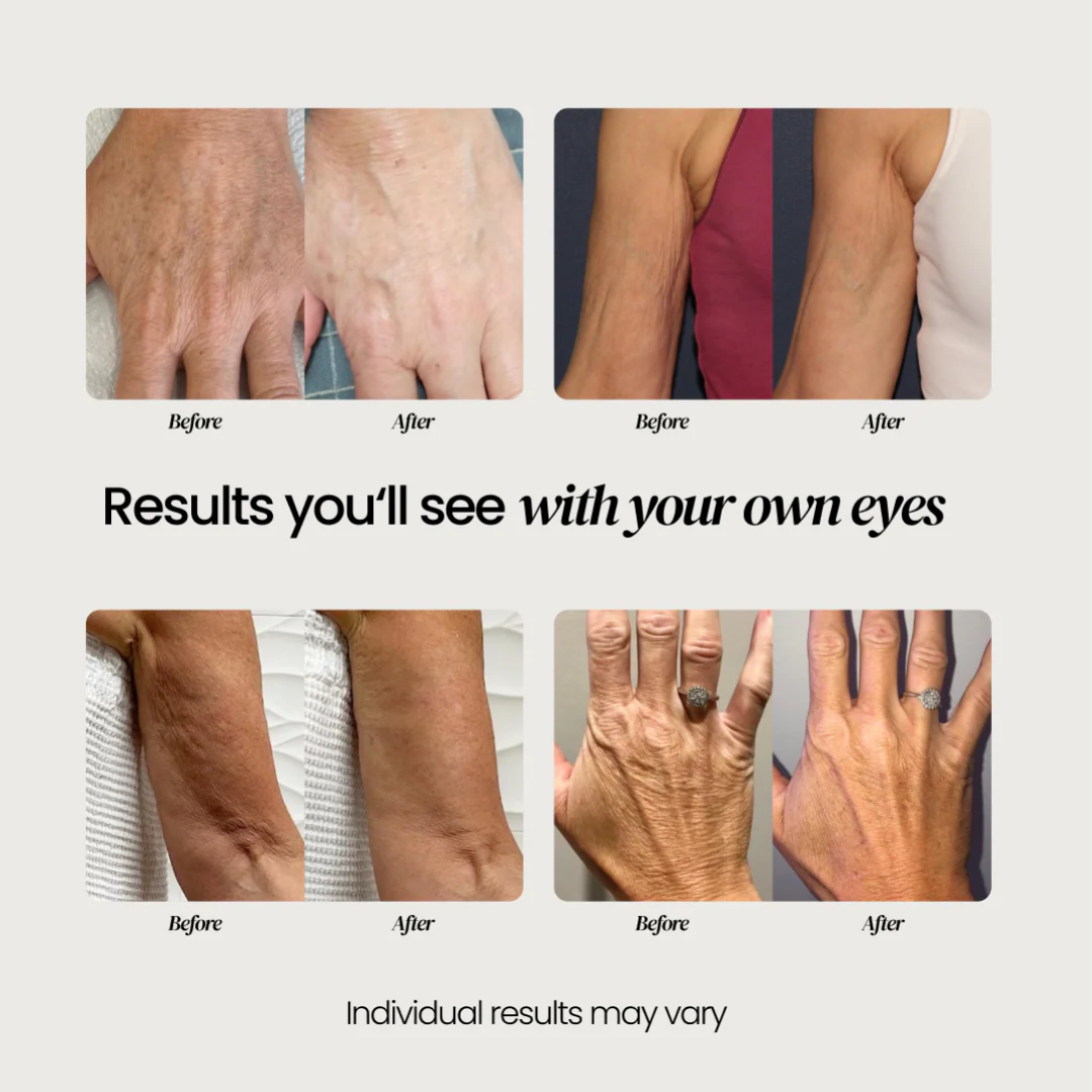 Advanced Crepe Fix for crepey, densely creased or paper like skin