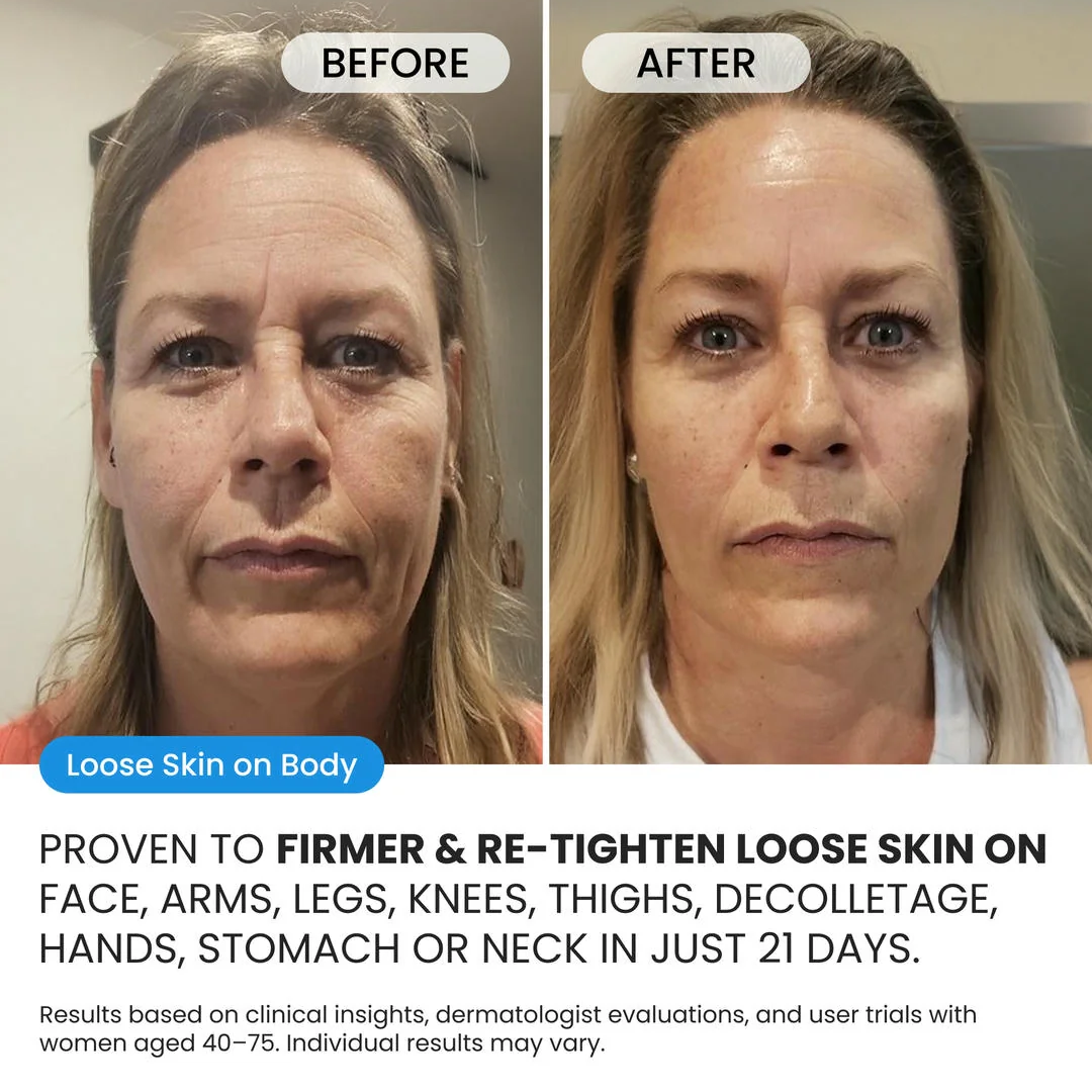 Advanced Crepe Fix for crepey, densely creased or paper like skin