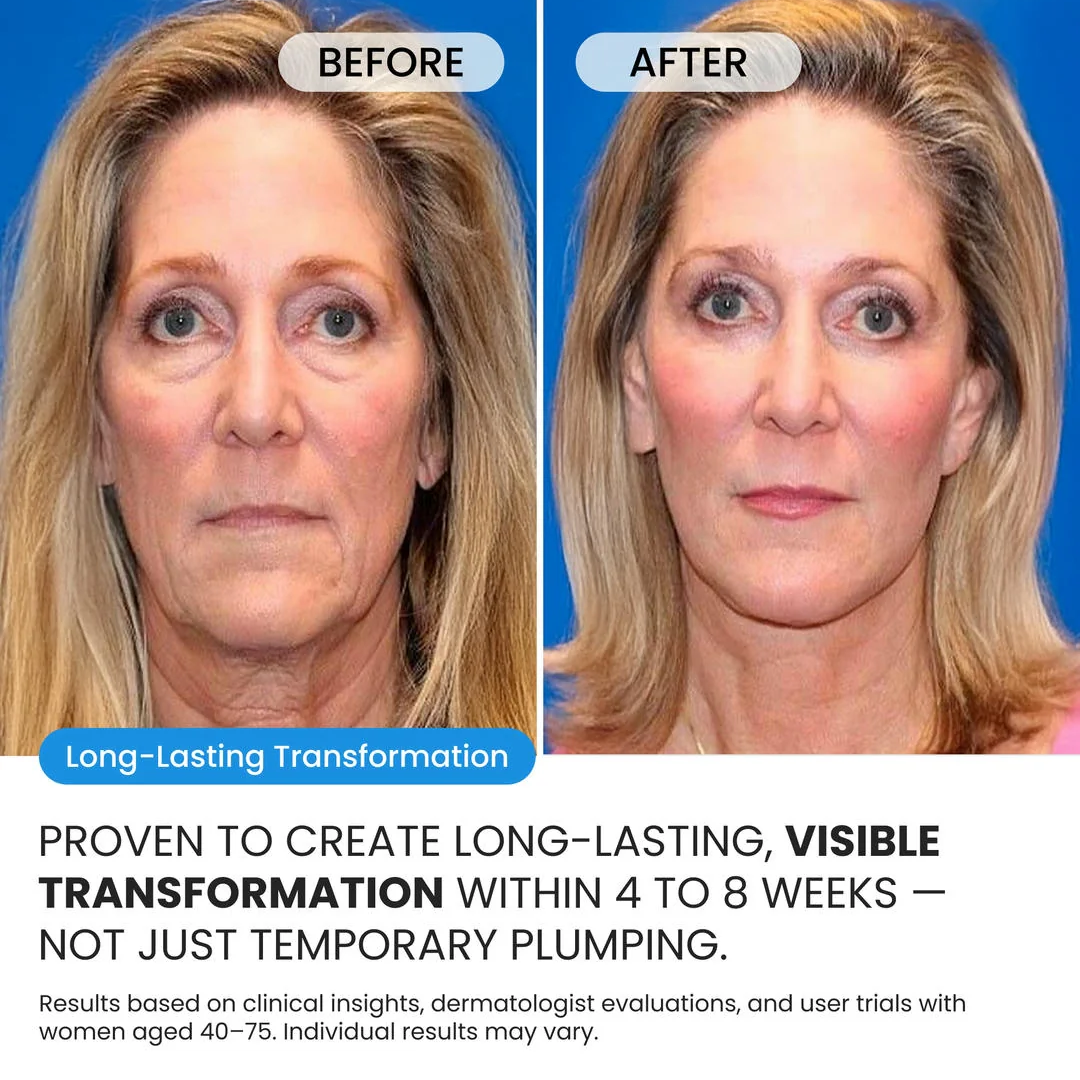 Advanced Crepe Fix for crepey, densely creased or paper like skin