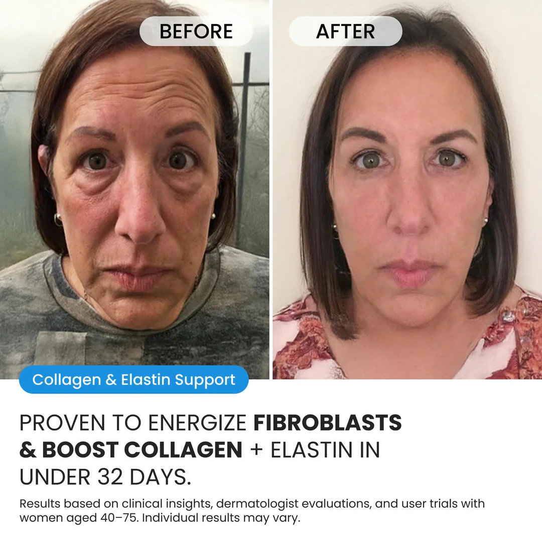 Advanced Crepe Fix for crepey, densely creased or paper like skin