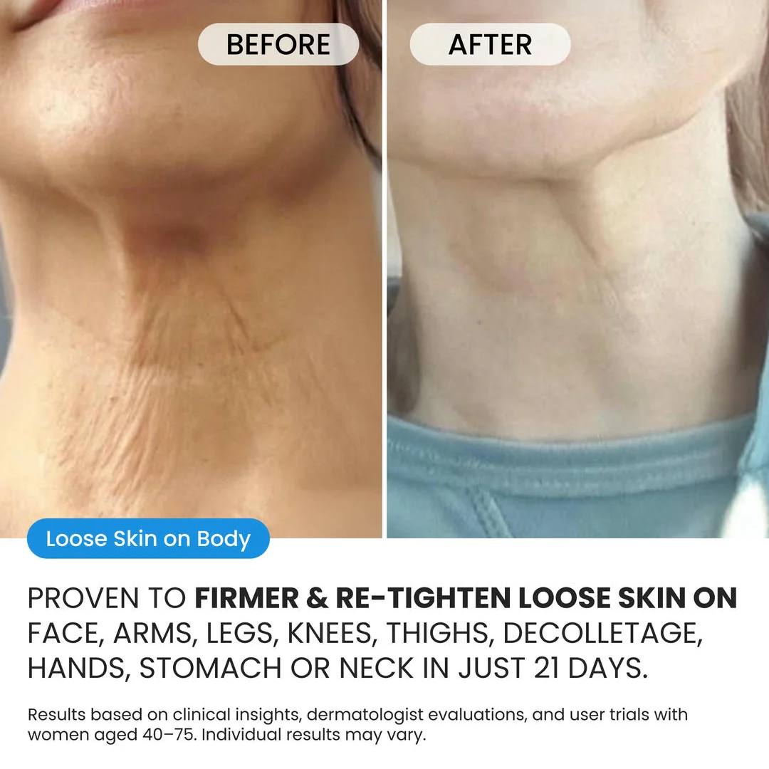 Advanced Crepe Fix for crepey, densely creased or paper like skin