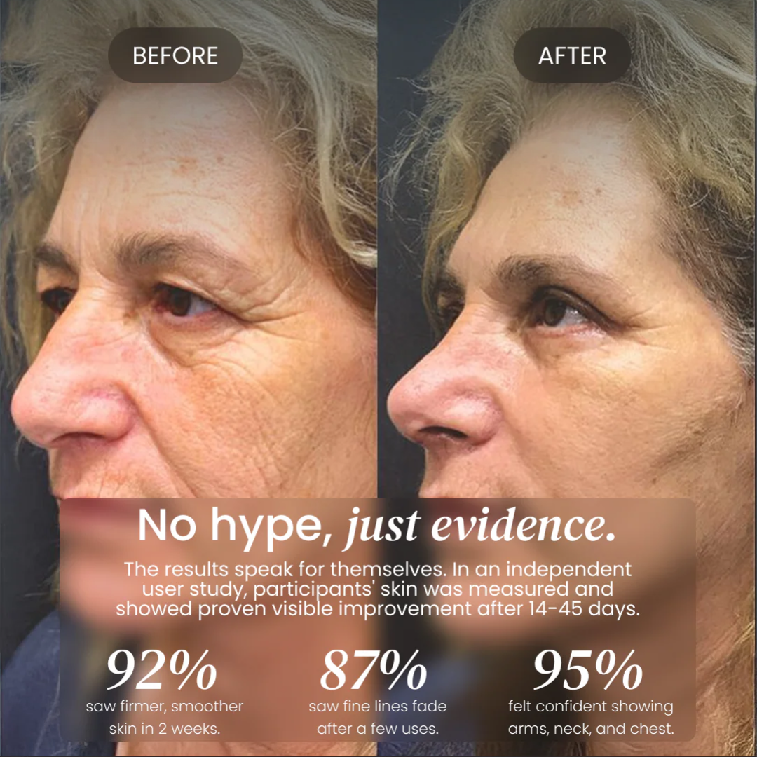 Advanced Crepe Fix for crepey, densely creased or paper like skin