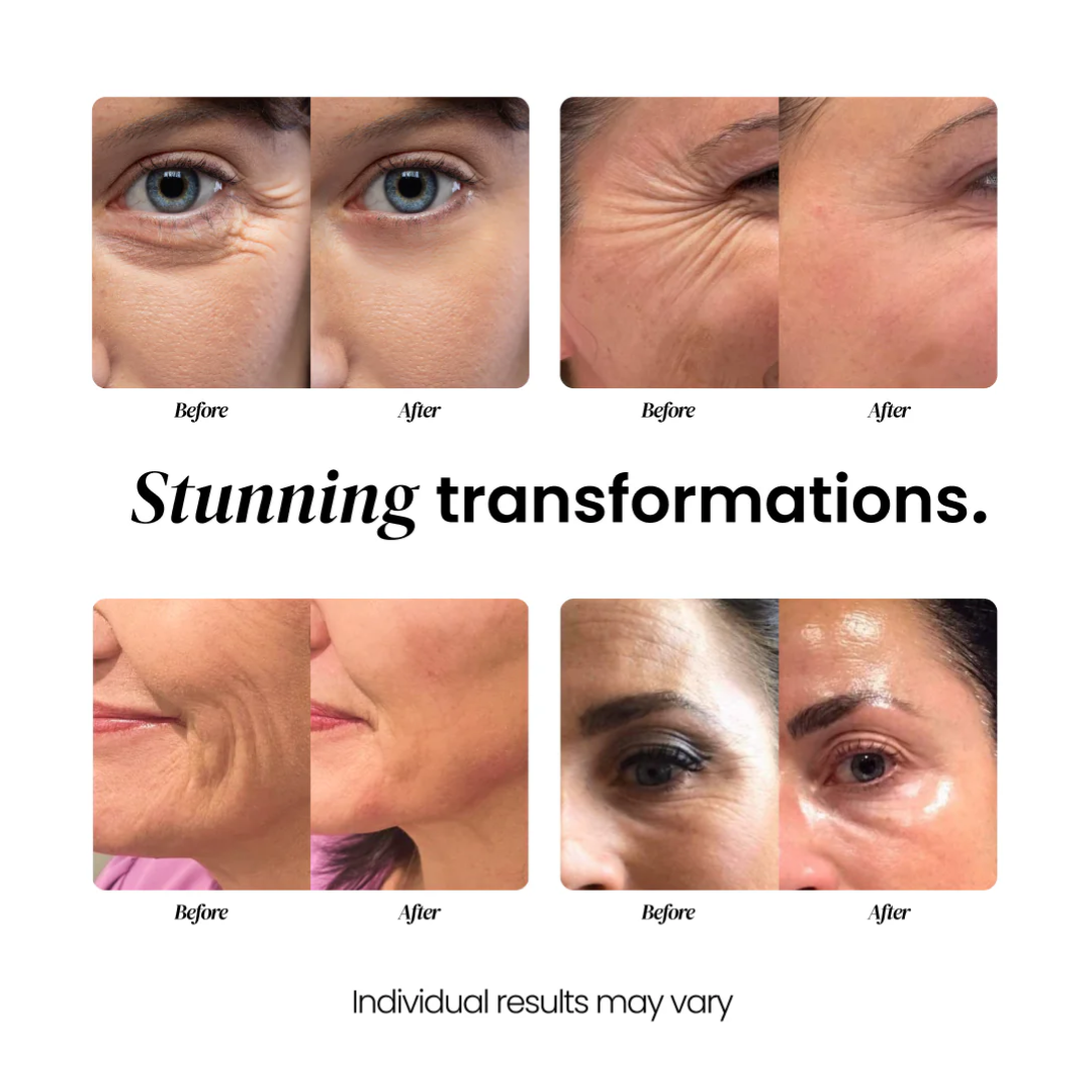 Aging Repair Cream for wrinkles, thinning and sagging skin