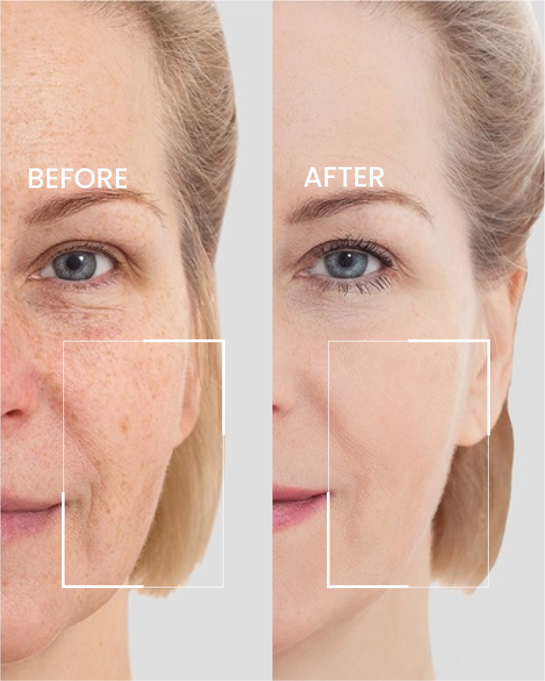 Anti Aging Face Cream