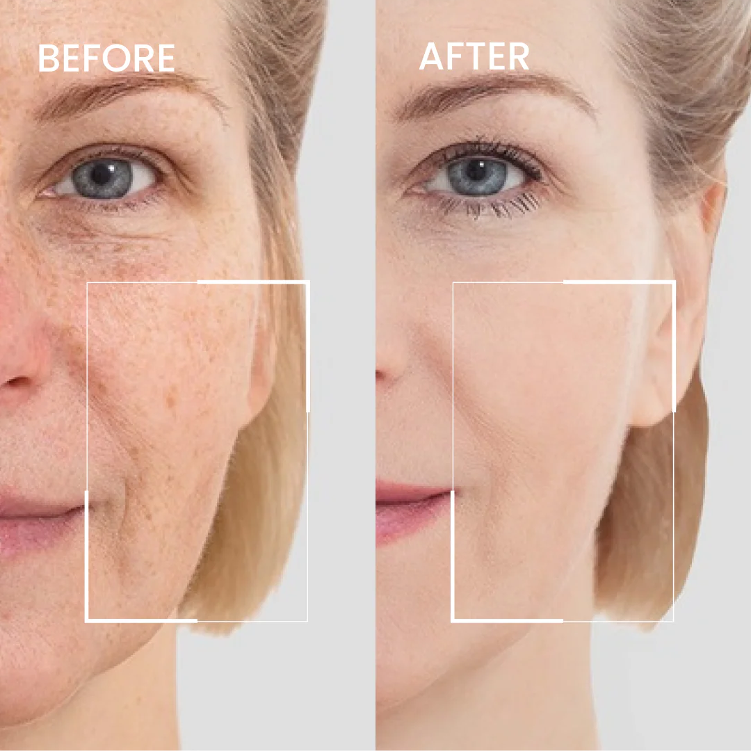 Aging Repair Cream for wrinkles, thinning and sagging skin