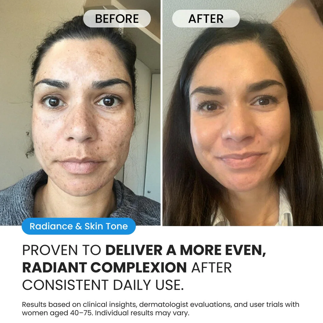 Dark Spot Corrector for Dark Spots, Melasma & Uneven Skin Tone