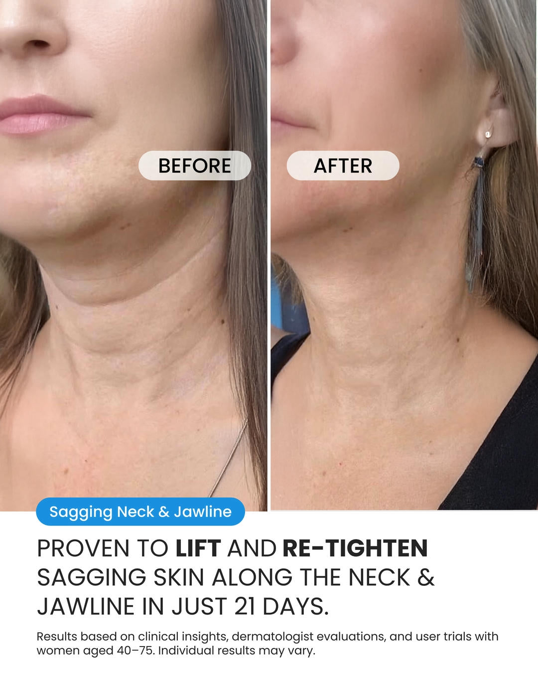 Neck Cream