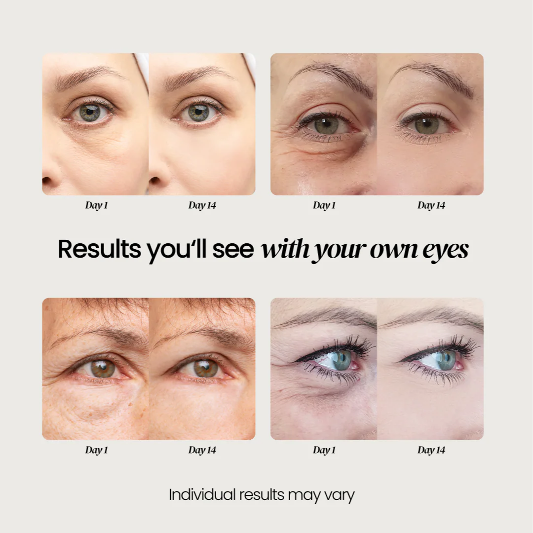 Firming Eye Cream for fines lines, deep wrinkles and under-eye puffiness