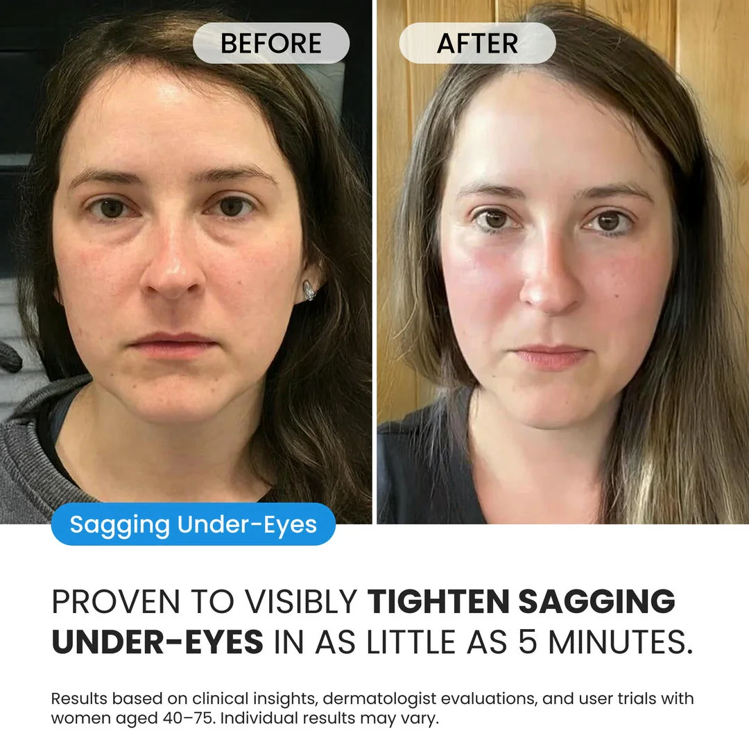 Firming Eye Cream for fines lines, deep wrinkles and under-eye puffiness