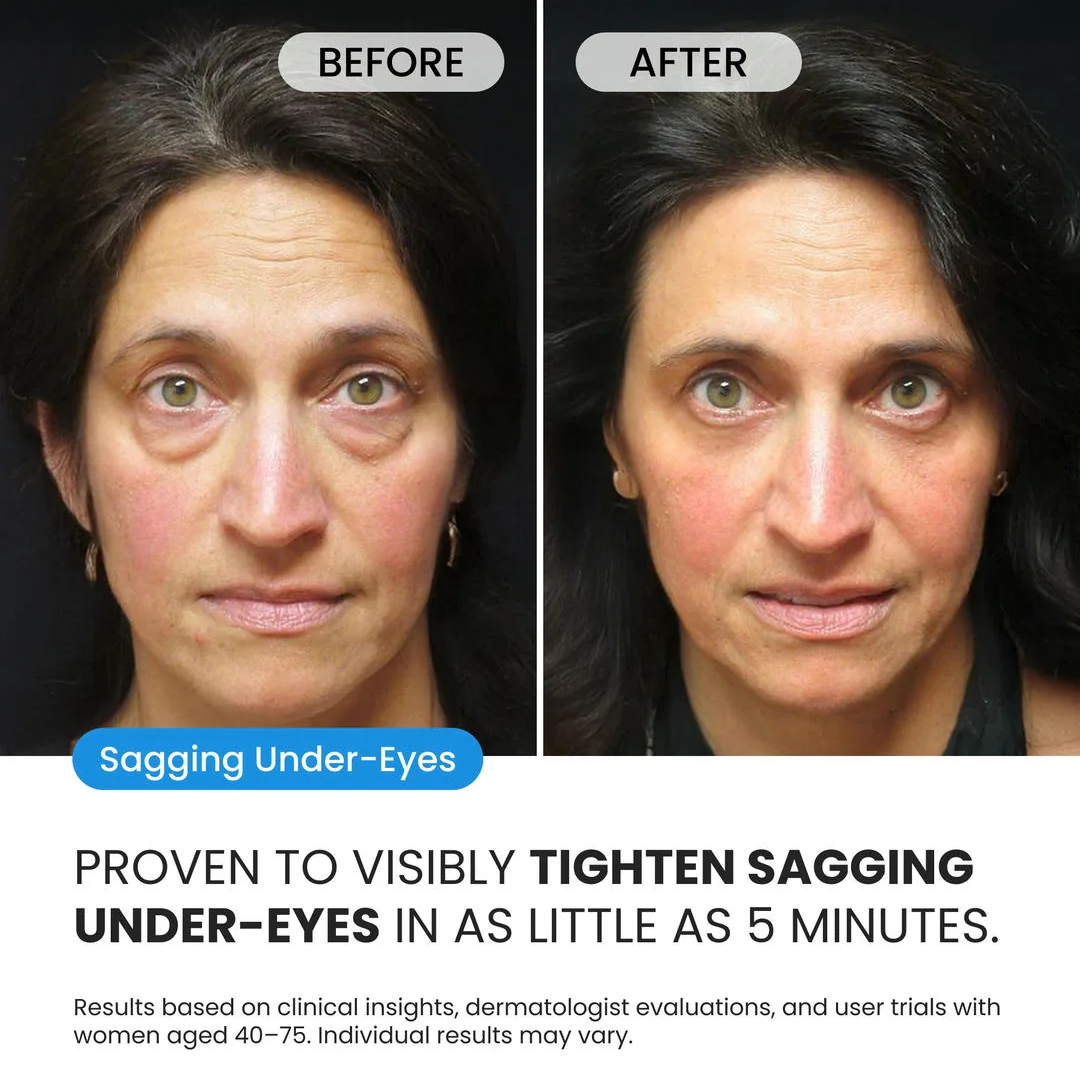 Firming Eye Cream for fines lines, deep wrinkles and under-eye puffiness