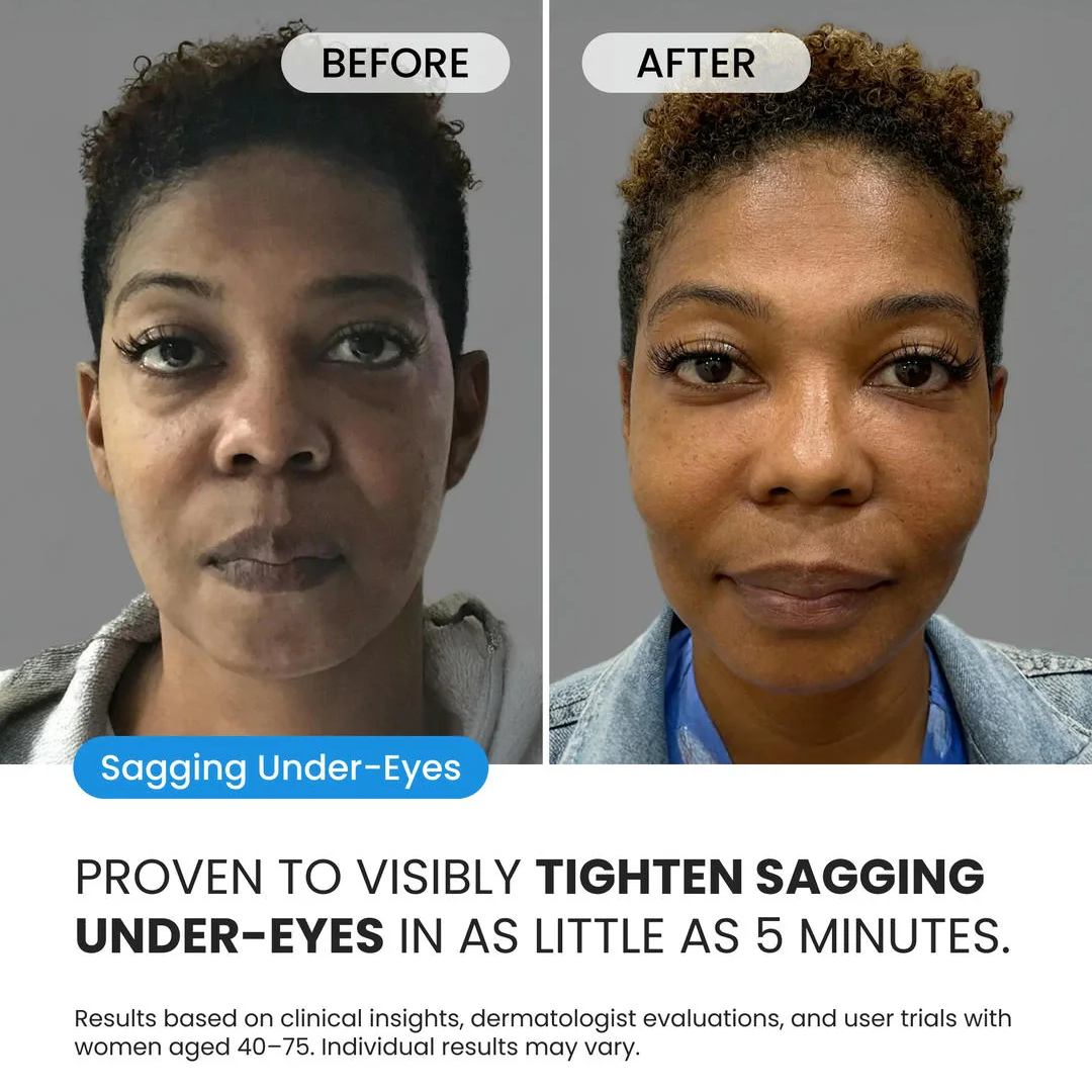 Firming Eye Cream for fines lines, deep wrinkles and under-eye puffiness