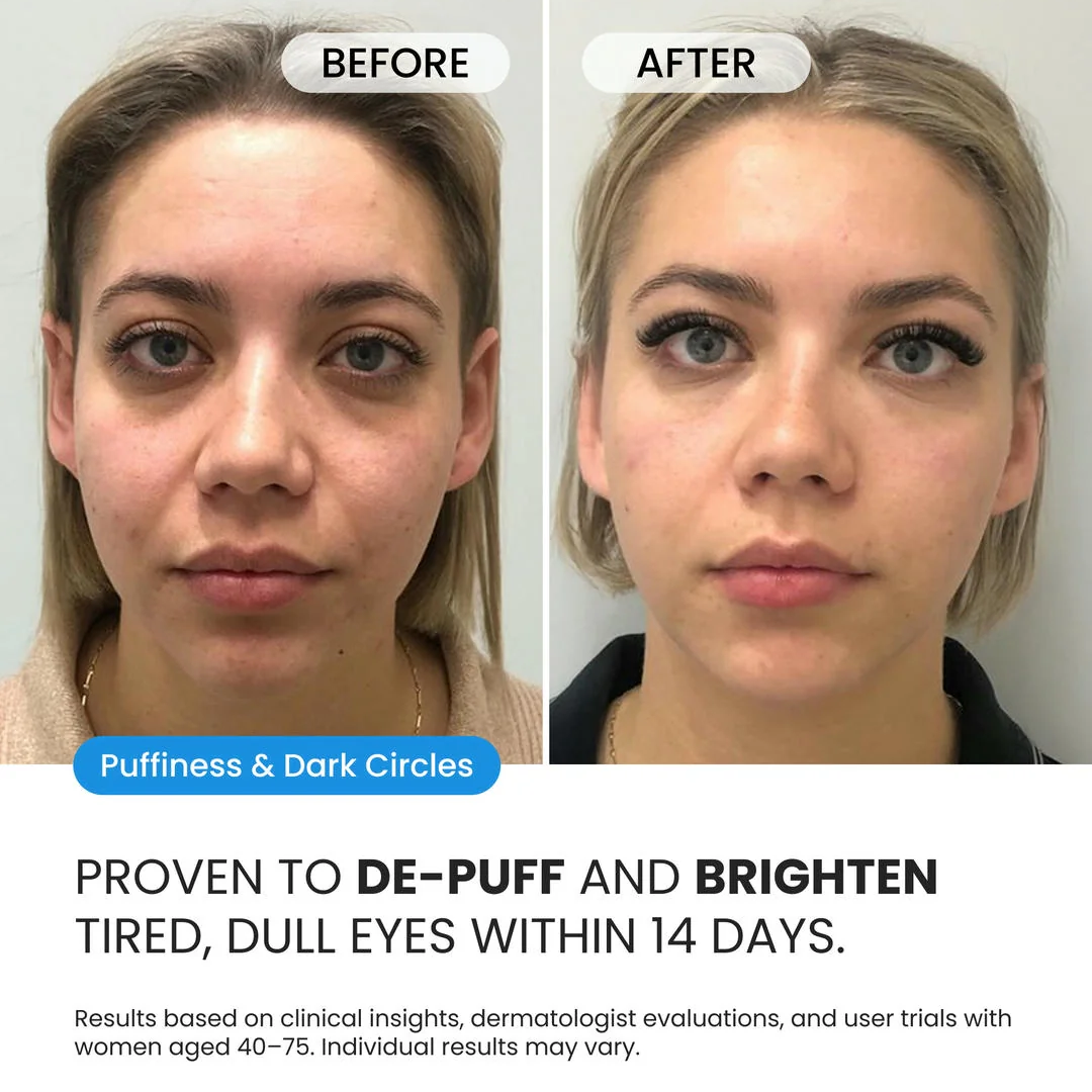 Firming Eye Cream for fines lines, deep wrinkles and under-eye puffiness