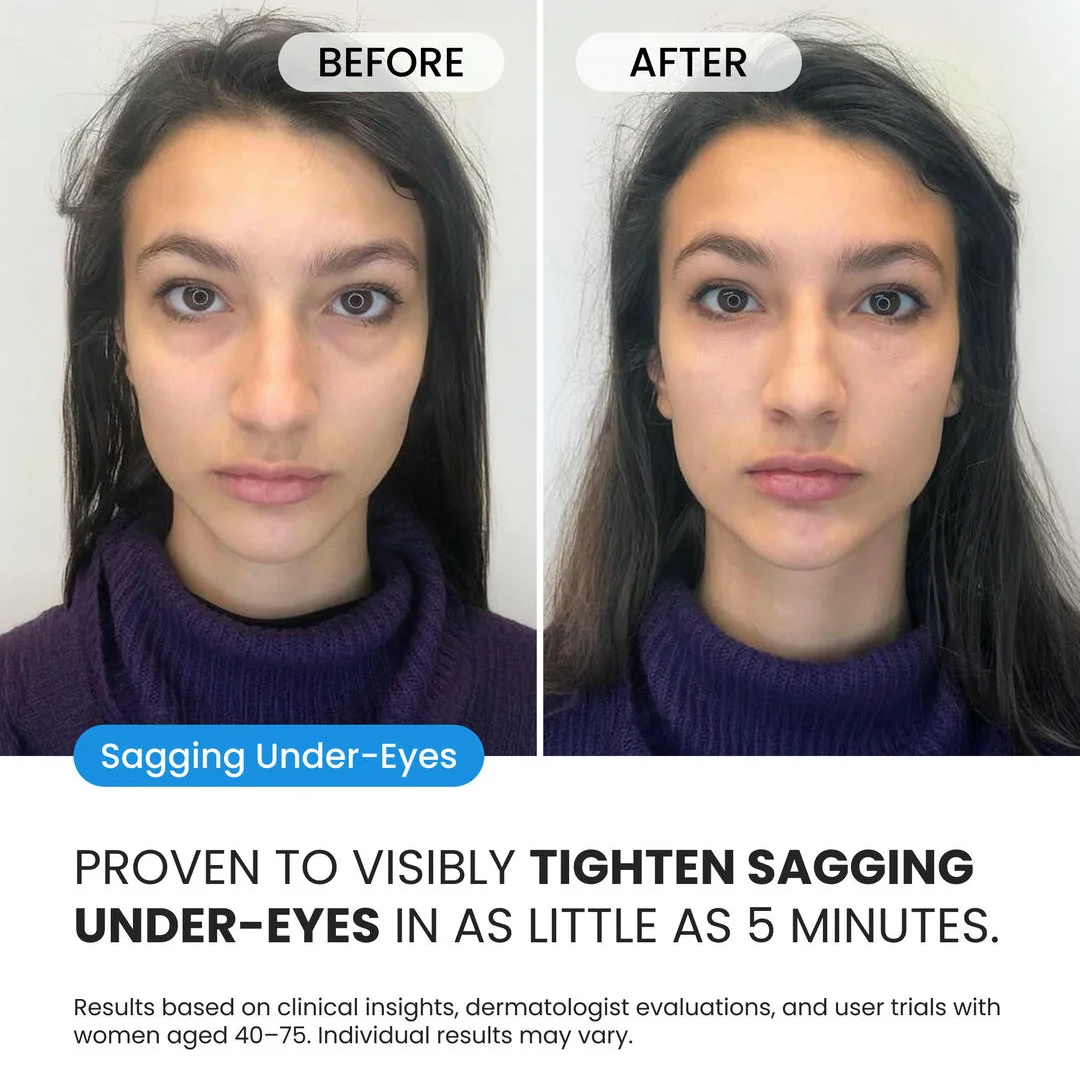 Firming Eye Cream for fines lines, deep wrinkles and under-eye puffiness