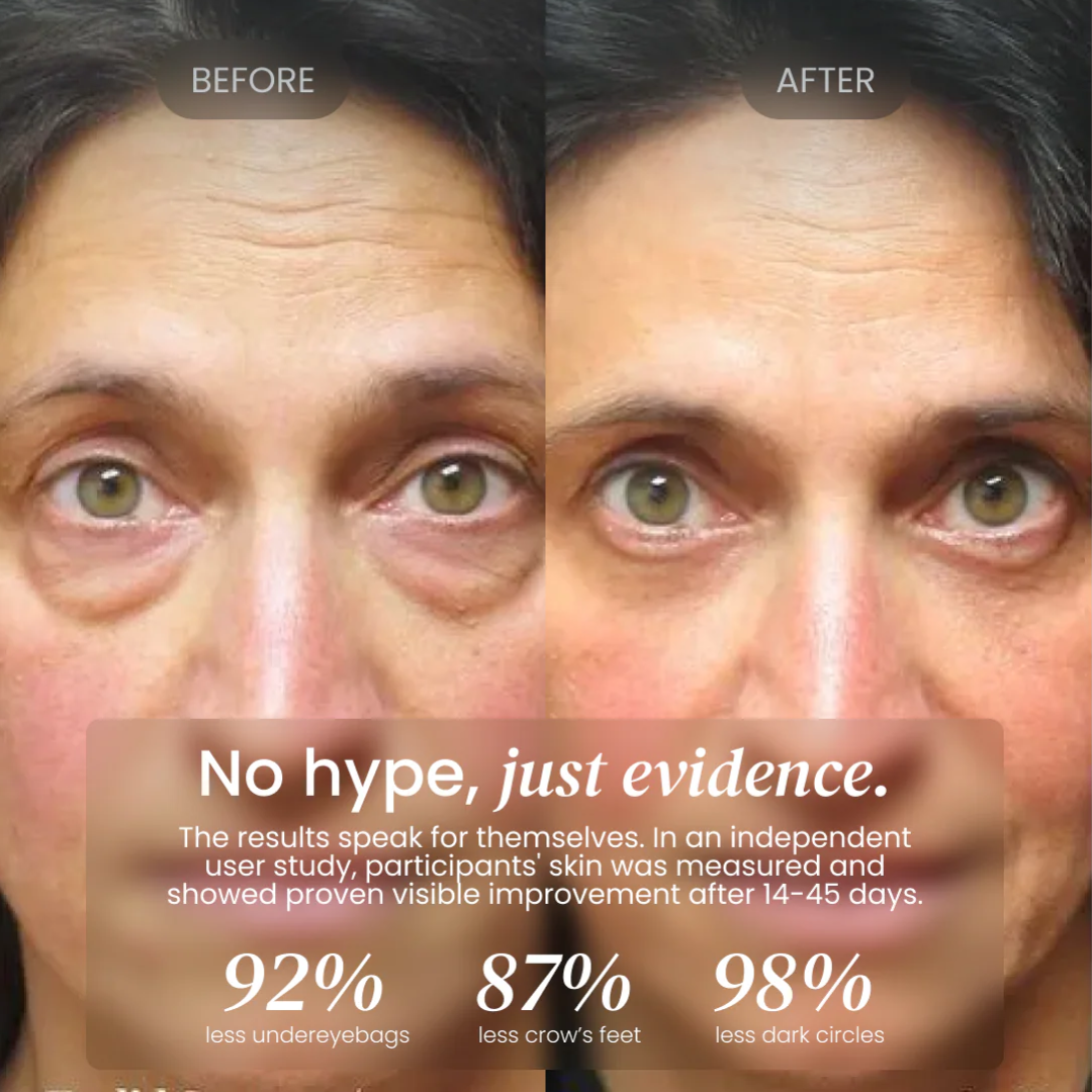 Firming Eye Cream for fines lines, deep wrinkles and under-eye puffiness