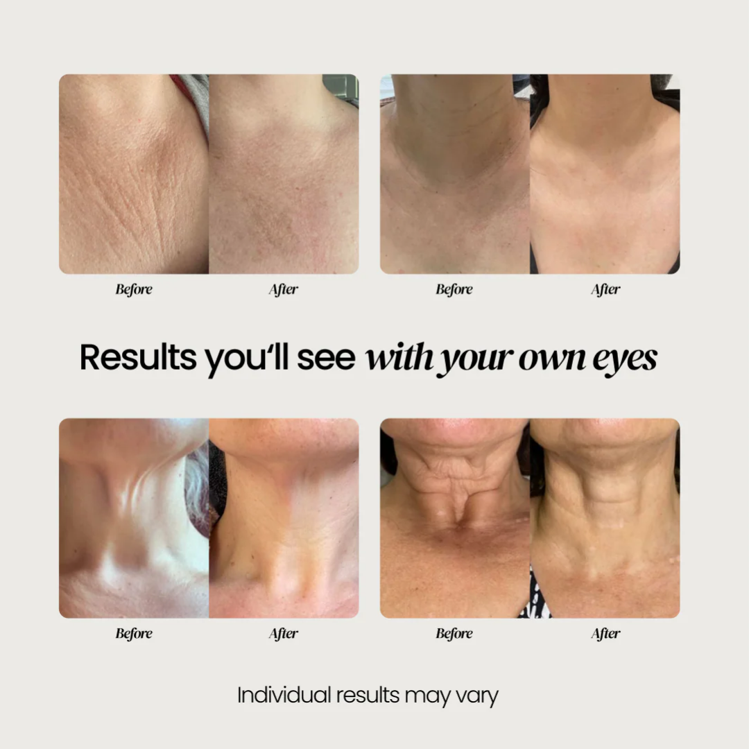 Neck Cream for sagging skin, deep creases and neck lines