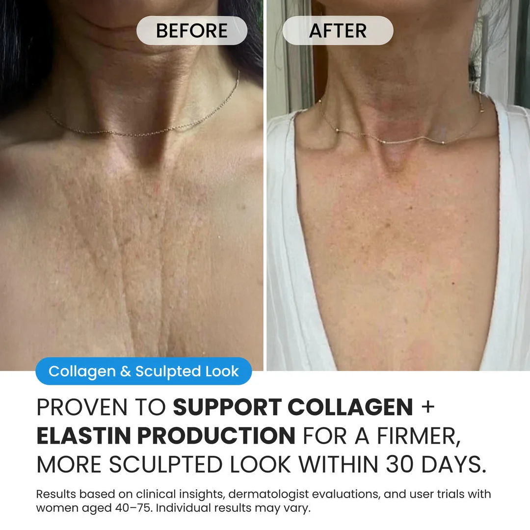 Neck Cream for sagging skin, deep creases and neck lines