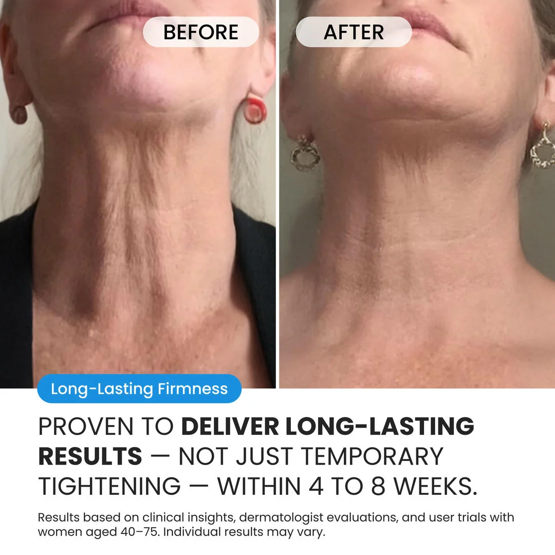 Neck Cream for sagging skin, deep creases and neck lines