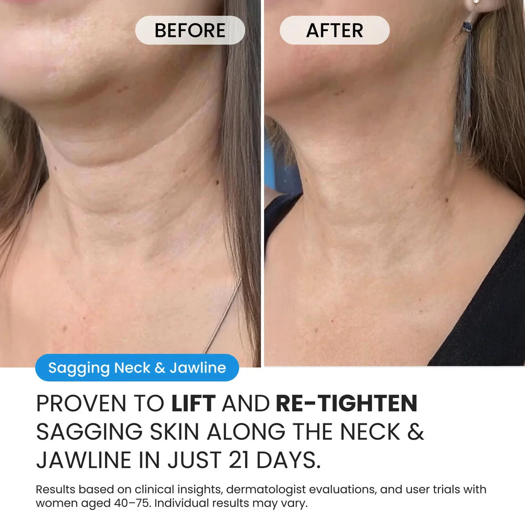 Neck Cream for sagging skin, deep creases and neck lines