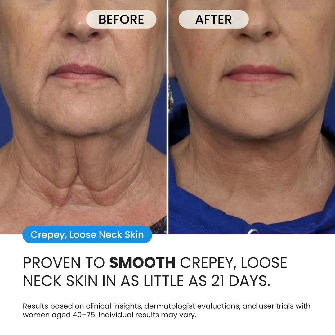 Neck Cream for sagging skin, deep creases and neck lines