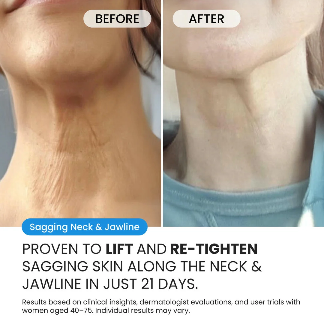 Neck Cream for sagging skin, deep creases and neck lines