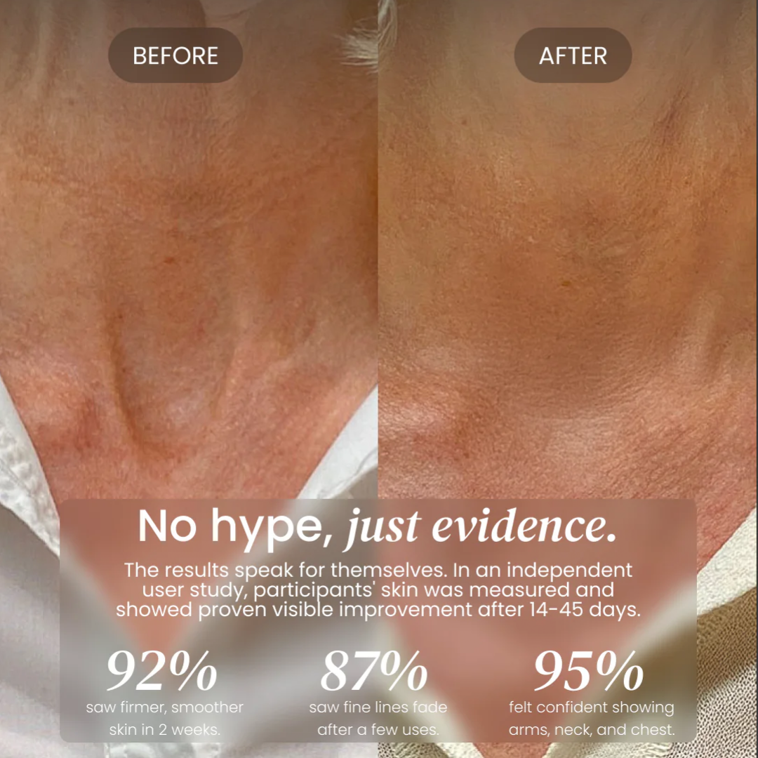 Neck Cream for sagging skin, deep creases and neck lines