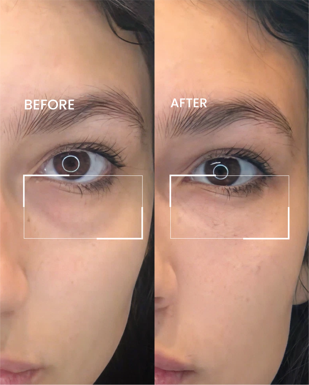 Eye Cream for Dark Circles