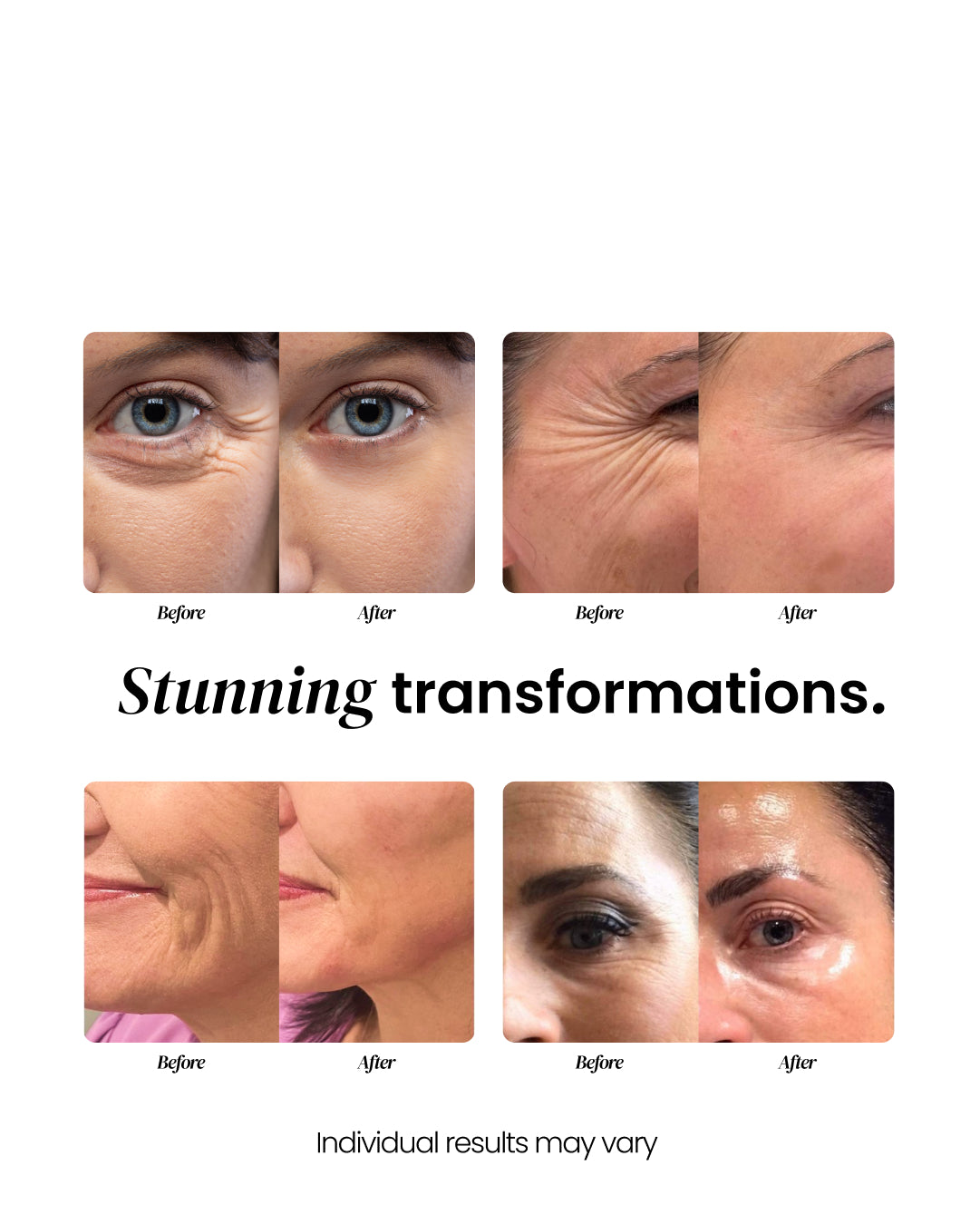 Anti Aging Face Cream 