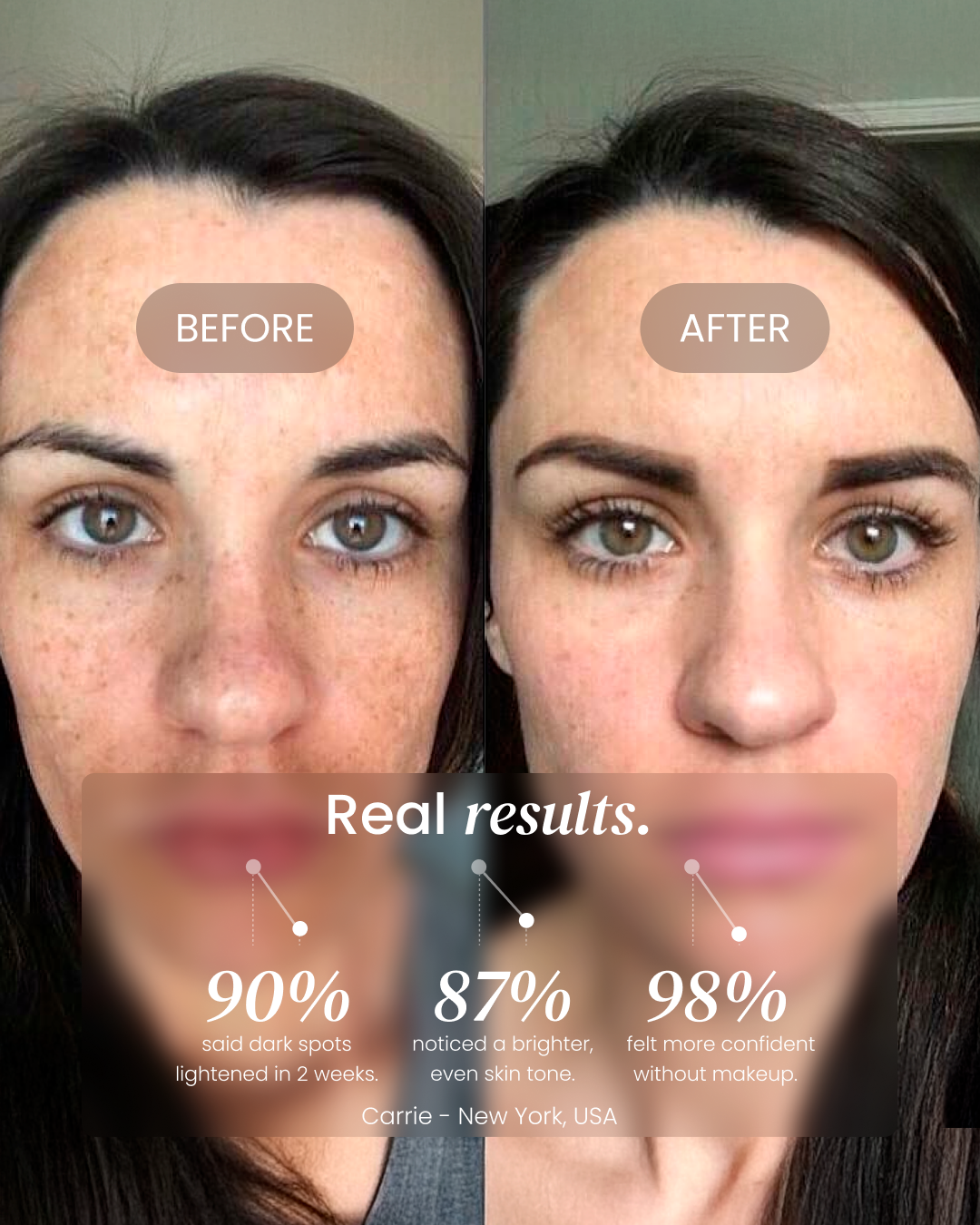 Dark Spot Corrector