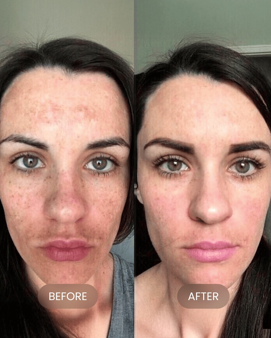 Dark Spot Corrector