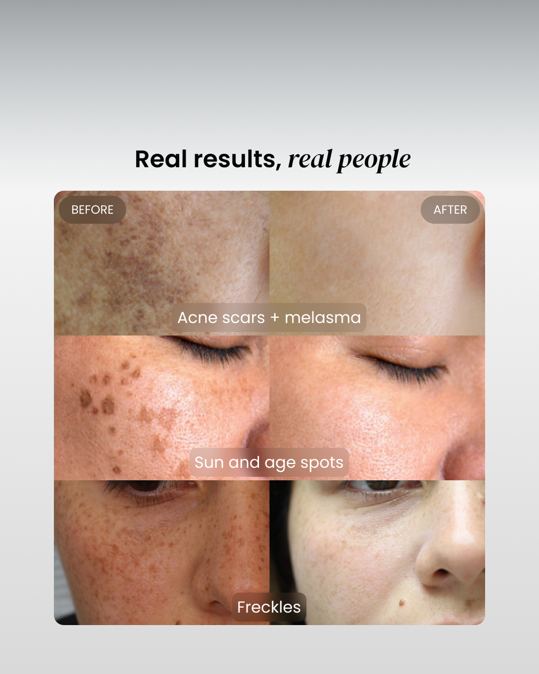Dark Spot Corrector