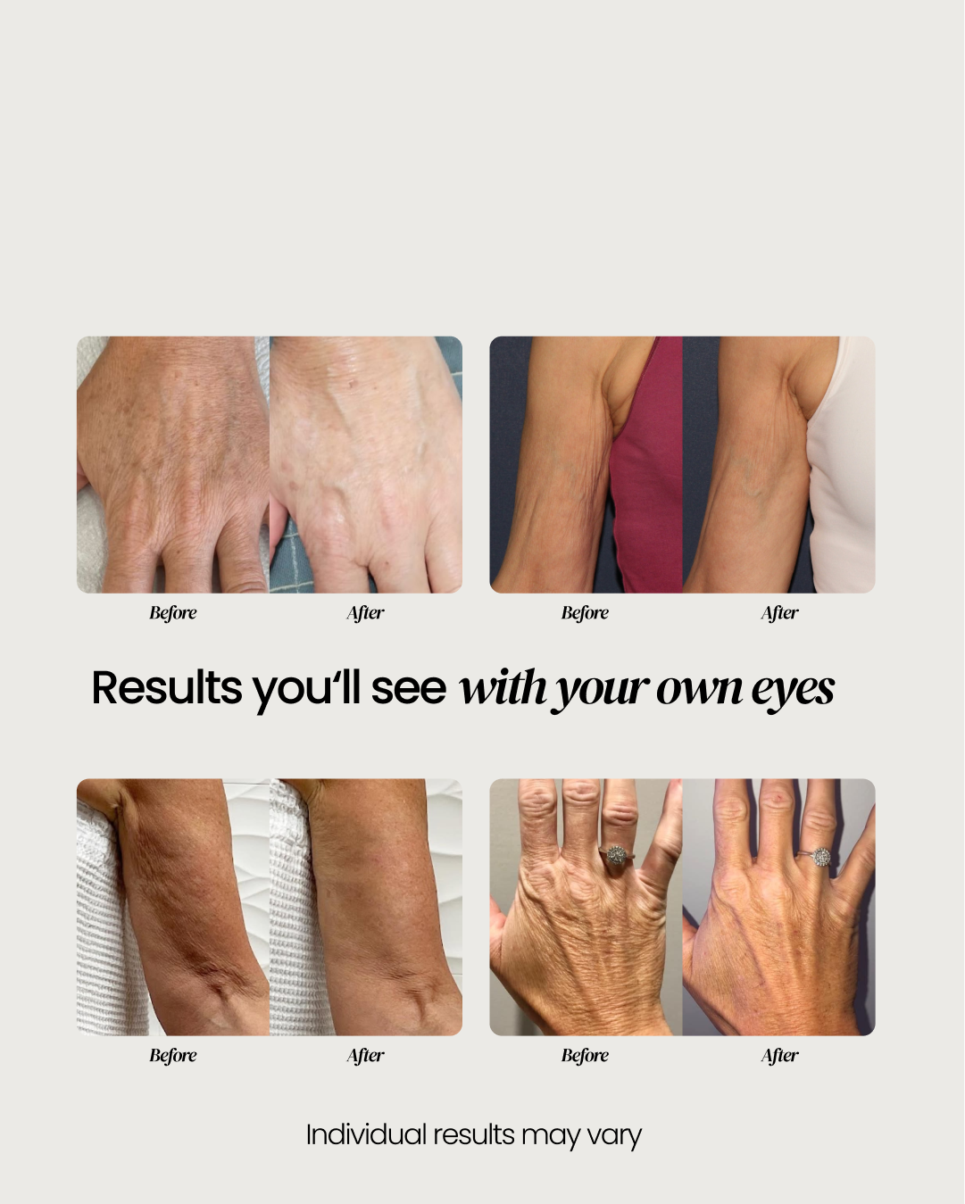 Crepe Skin Cream