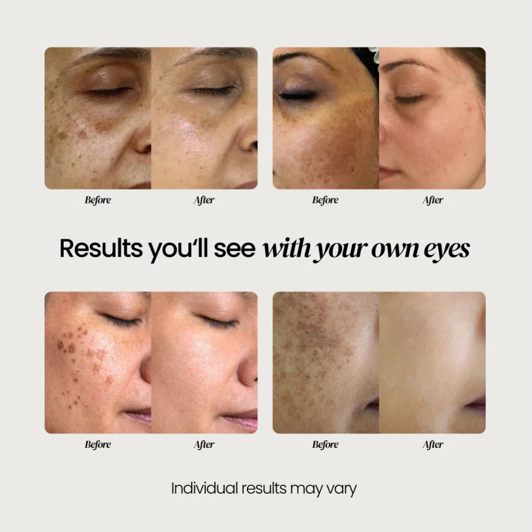 Dark Spot Corrector
