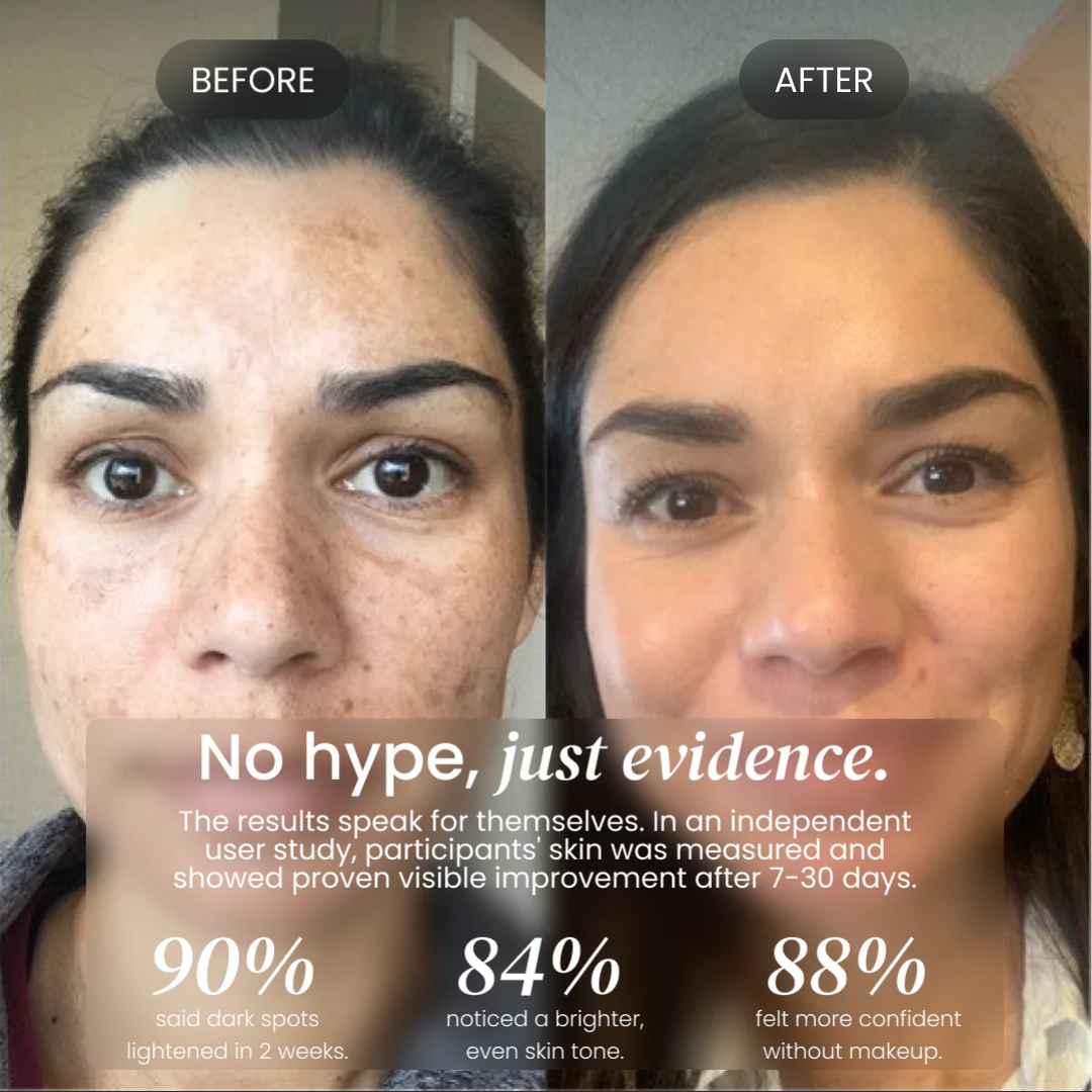 Dark Spot Corrector