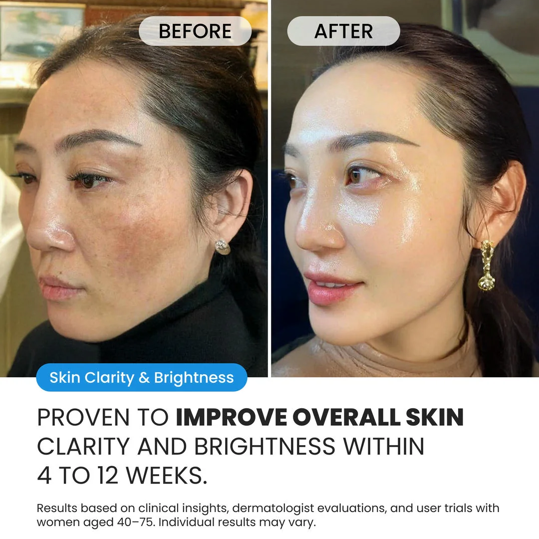 Dark Spot Corrector