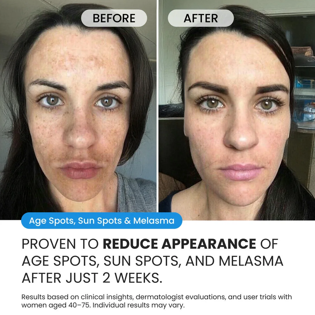 Dark Spot Corrector