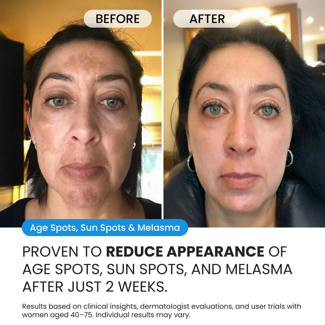 Dark Spot Corrector