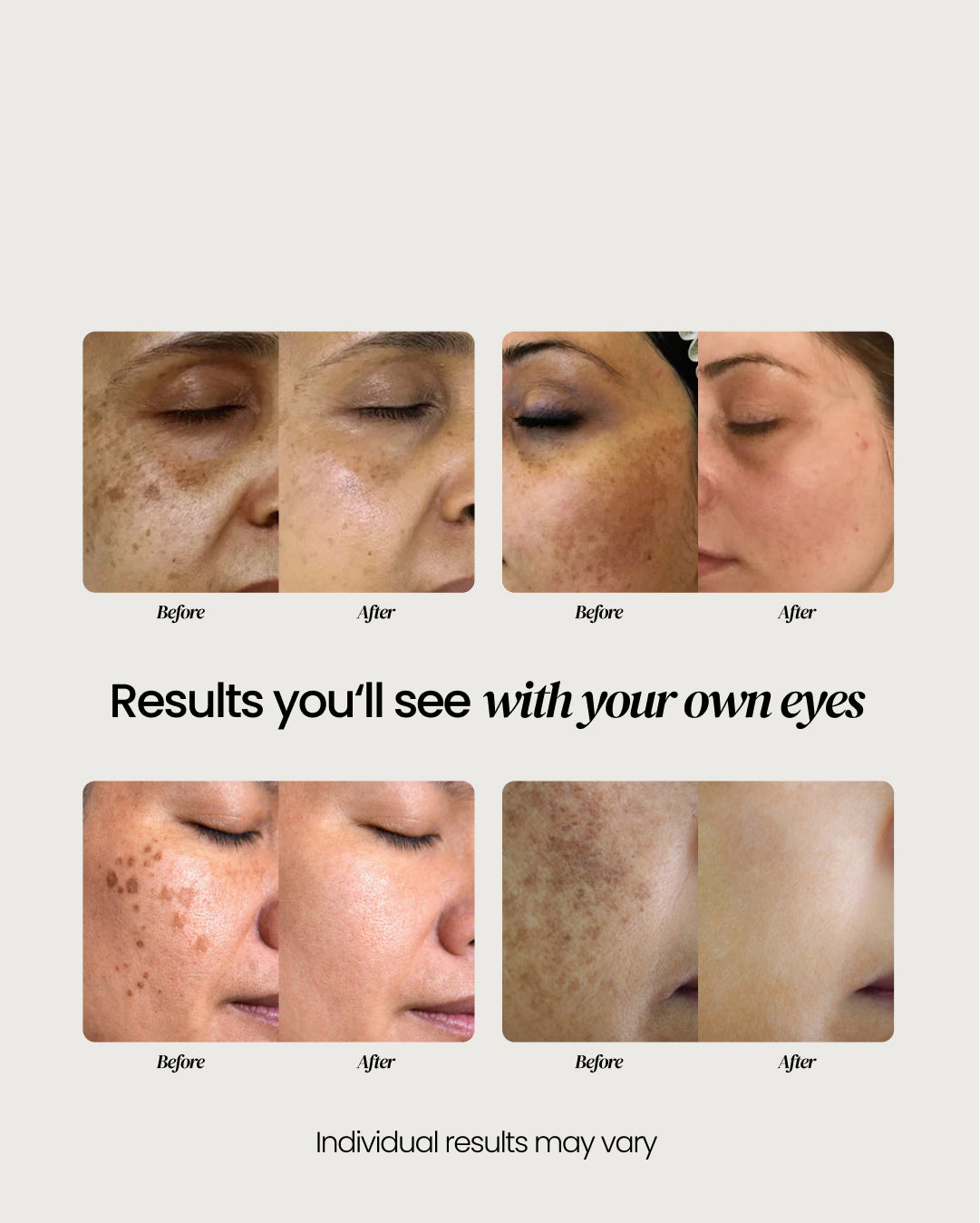 Dark Spot Corrector