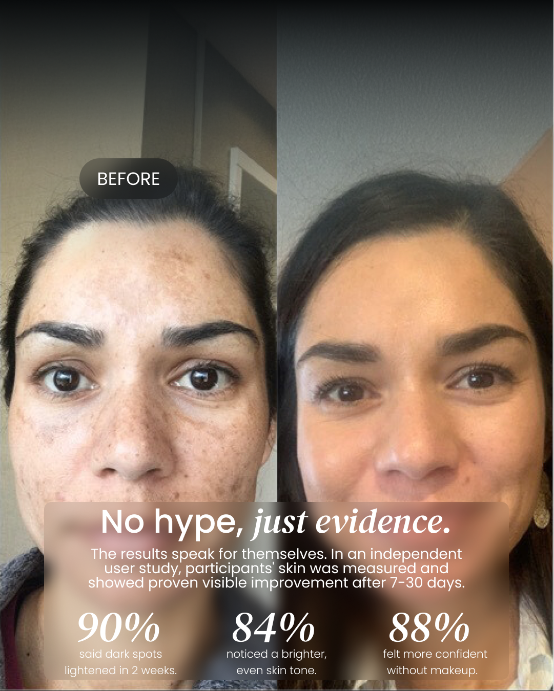 Dark Spot Corrector
