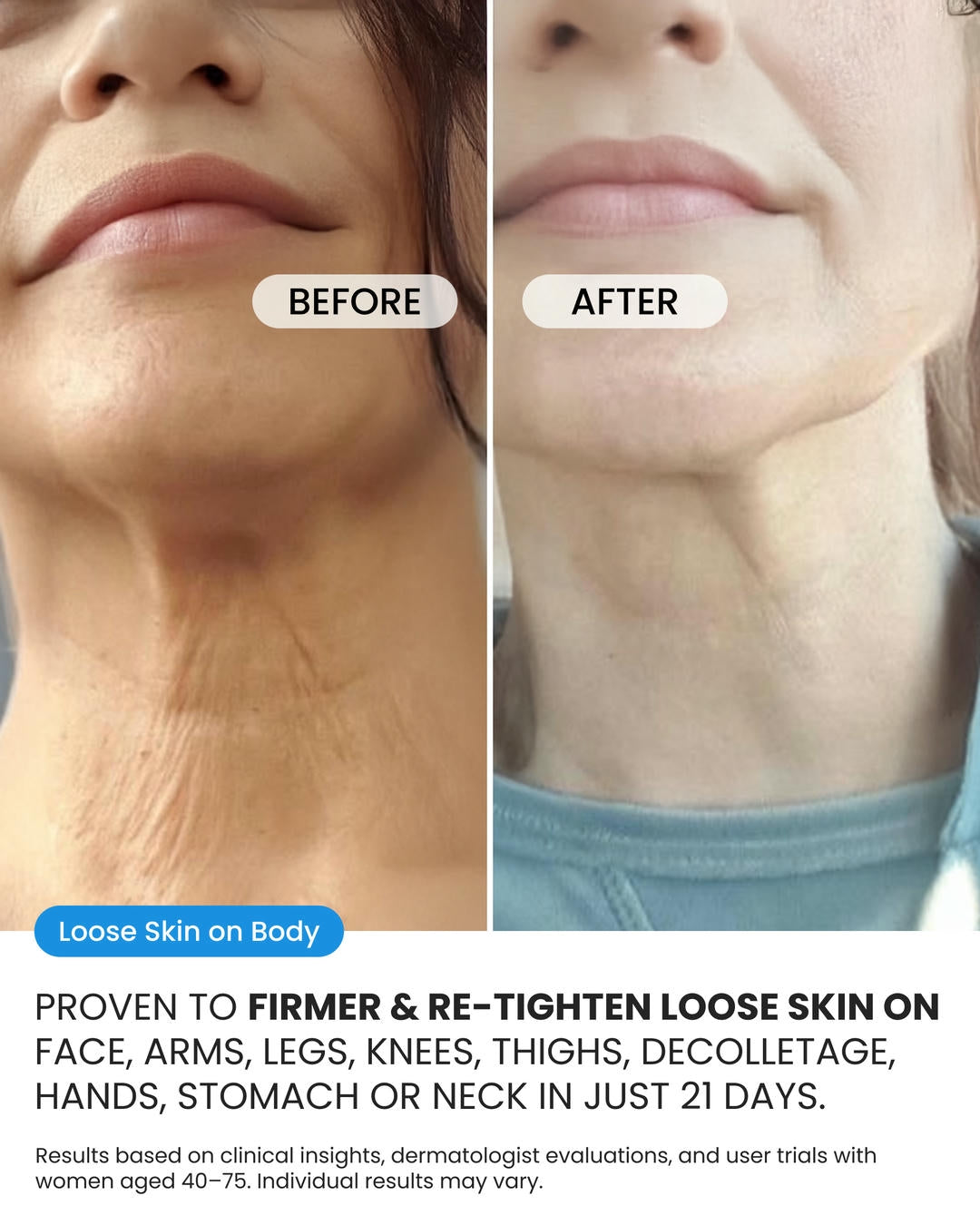 Crepe Skin Cream