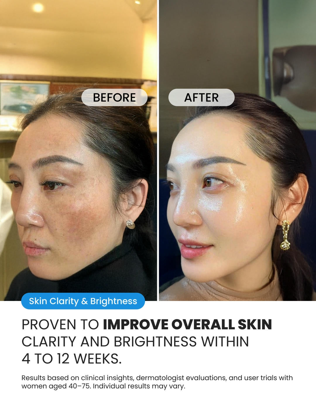 Dark Spot Corrector