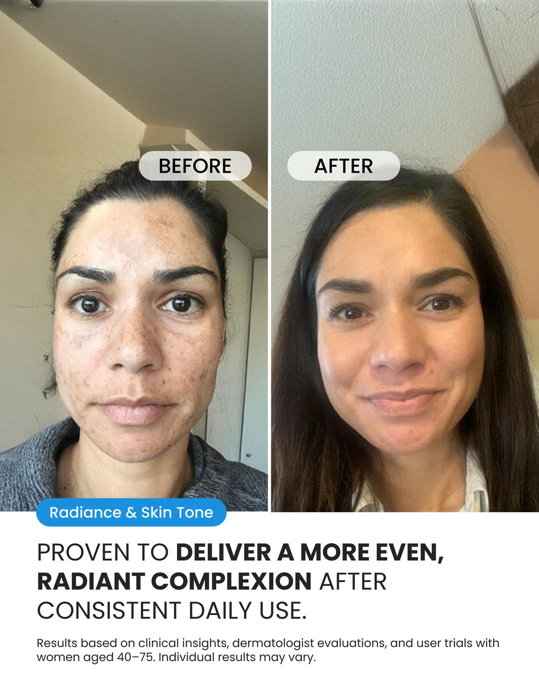 Dark Spot Corrector