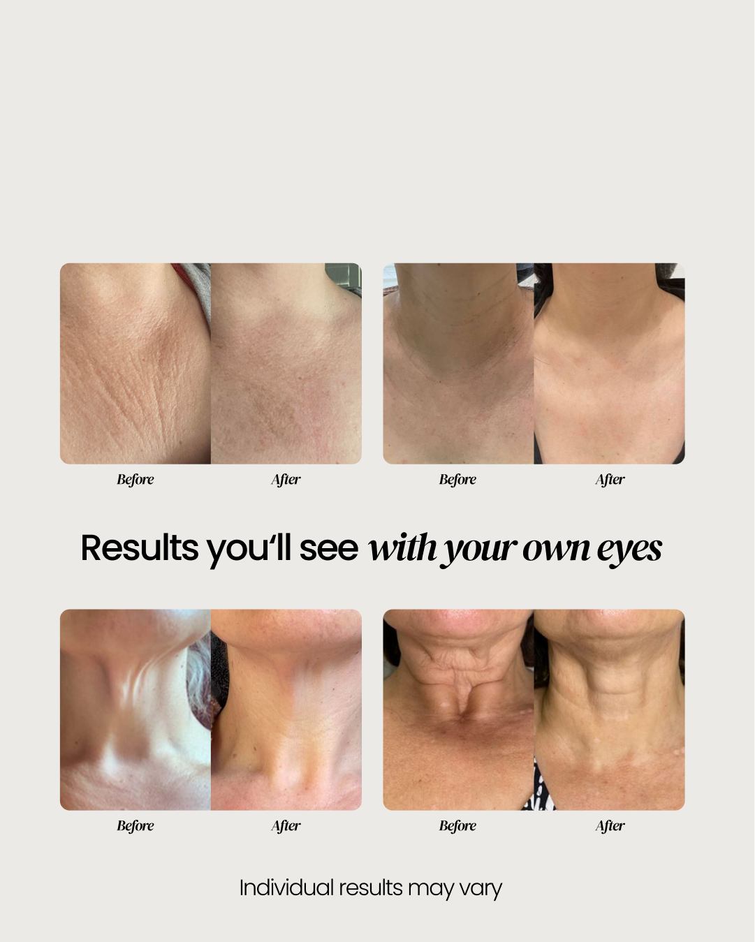 Neck Cream