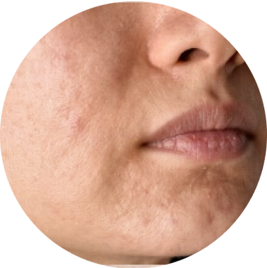 Uneven Skin Tone menu image