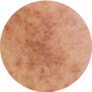 Dark Spots menu image