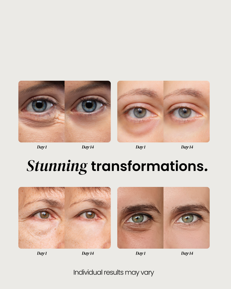 Eye Cream for Dark Circles 